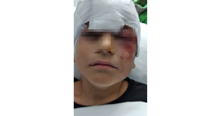 Sokak ortasında kangal dehşeti! Yaralanan çocuğun başına 52 dikiş attılar